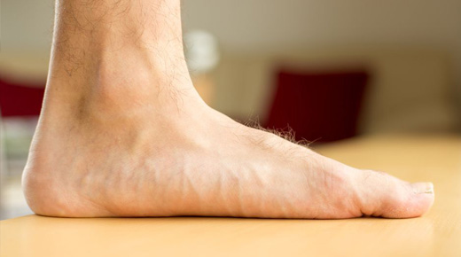 Flat feet